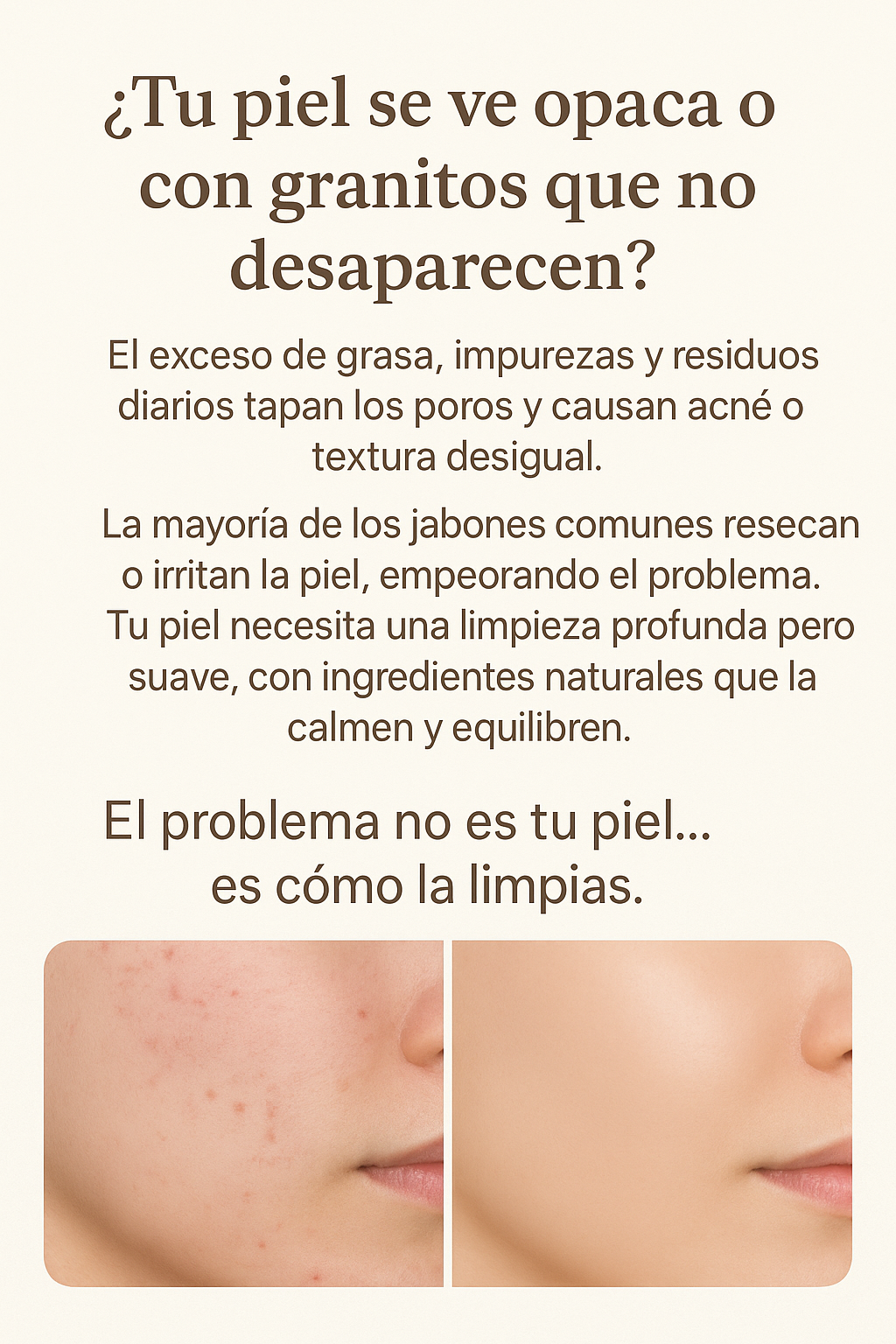 Jabón de Cúrcuma + Ácido Kójico – PROMO 2x1 ✨ Eliminador de Manchas y Acné - 100% ORIGINAL + ENVIO GRATIS 🎁